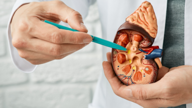 A Comprehensive Guide to Kidney Cancer 8 A Comprehensive Guide to Kidney Cancer